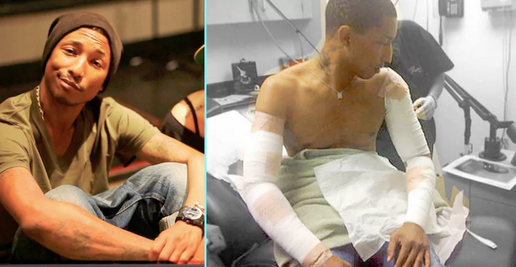 17 Pharrell Williams Had A Skin Graft To Remove His Tattoos.
